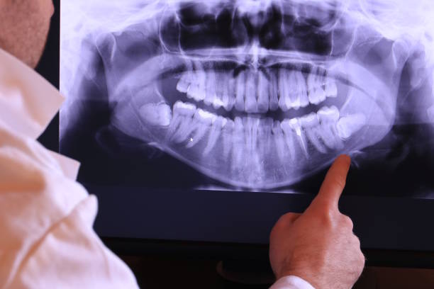 Best Tooth Infection Emergency Dentist  in La Verkin, UT