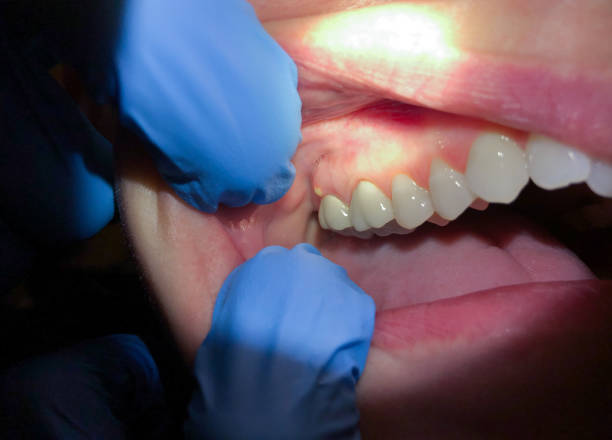 Best Knocked-Out Tooth Emergency  in La Verkin, UT